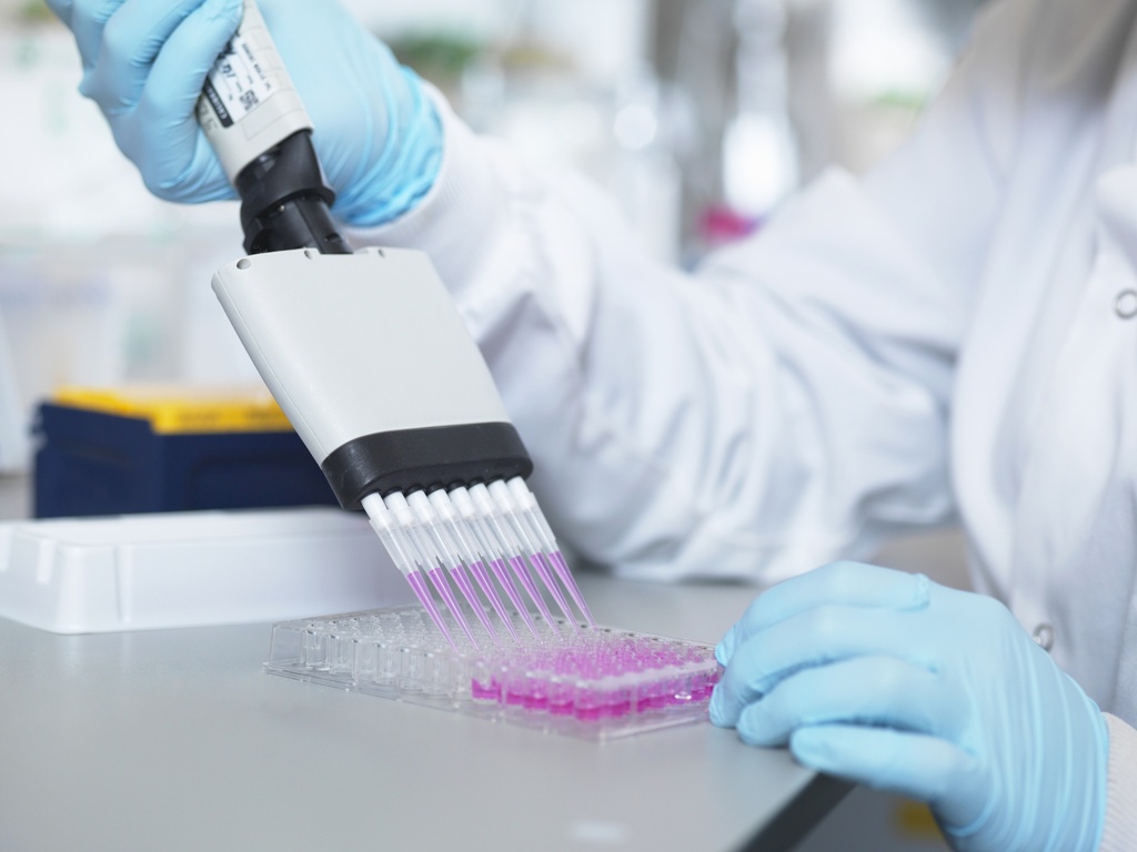 Mouse IgE ELISA Kit   